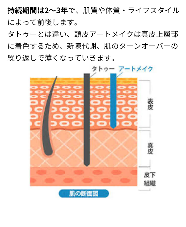 持続期間は2〜3年で、肌質や体質・ライフスタイルによって前後します。タトゥーとは違い、ヘアアートメイクは表皮に着色するため、新陳代謝、肌のターンオーバーの繰り返しで薄くなっていきます。