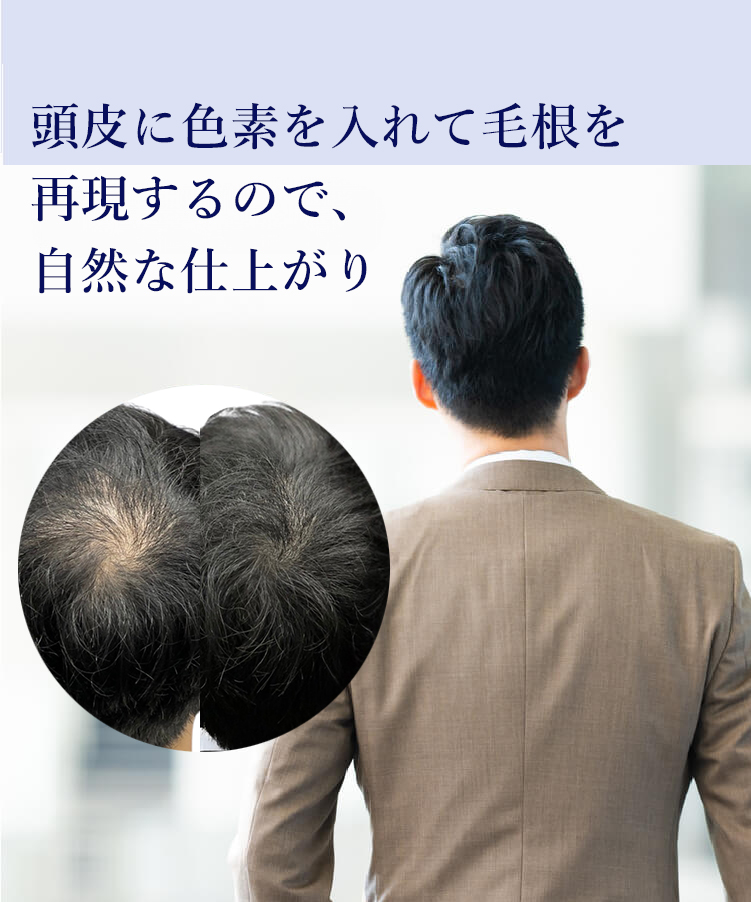 頭皮に直接毛を描くので、自然な仕上がり