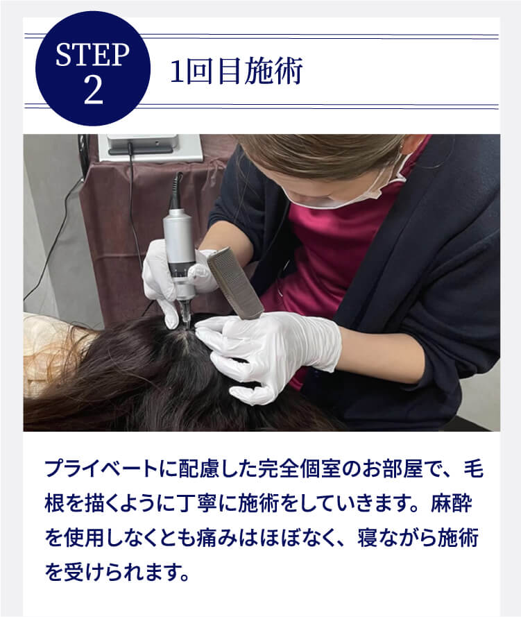 STEP2 1回目施術 プライベートに配慮した完全個室のお部屋で、毛根を描くように丁寧に施術をしていきます。麻酔を使用しなくとも痛みはほぼなく、寝ながら施術を受けられます。