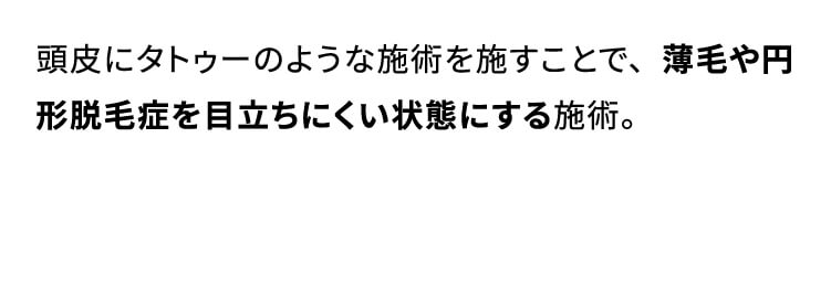 頭皮にタトゥーのような施術を施すことで、薄毛や円形脱毛症を目立ちにくい状態にする施術。