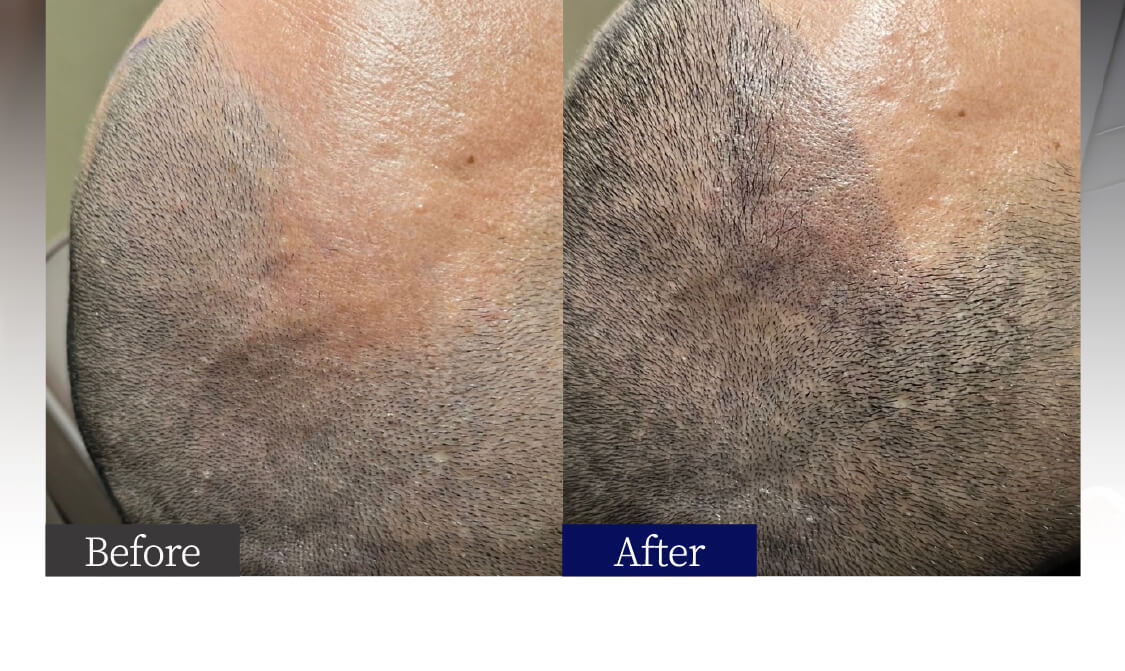 before after