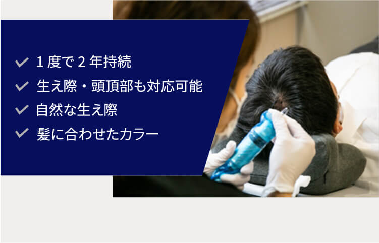 1度で2年持続 生え際・頭頂部も対応可能 自然な生え際 髪に合わせたカラー