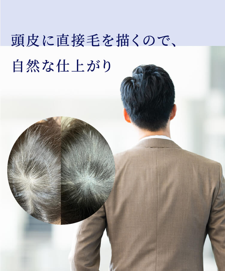 頭皮に直接毛を描くので、自然な仕上がり
