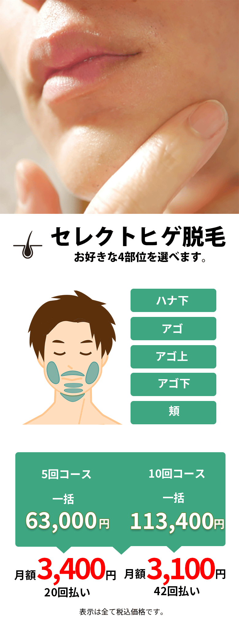 部分脱毛はこちら
