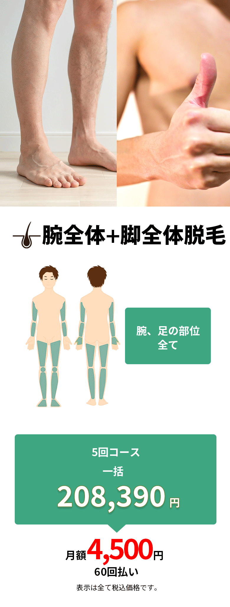 腕全体＋足全体脱毛はこちら